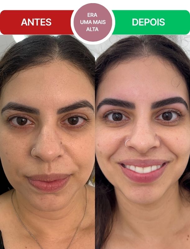 ANTES-E-DEPOIS-DA-MANU--Bloco-2.jpg