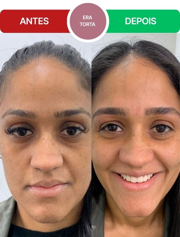 ANTES-E-DEPOIS-FERNANDA-Bloco-2.jpg